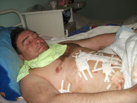 10 ножевых ран руководителя СМИ не интересуют местную милицию (фото)