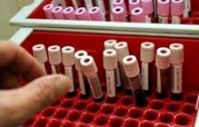 Что может вызвать развитие рака крови. Симптомы, лечение, факторы риска