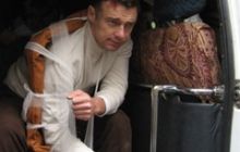 В Днепродзержинске избили оппозиционного депутата