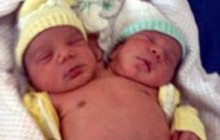В Бразилии родился здоровый двухголовый ребенок (фото)