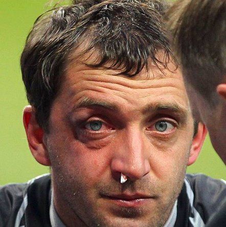 Воротар збірної України отримав тяжку травму (фото)