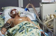 У Києві проломили череп єврею