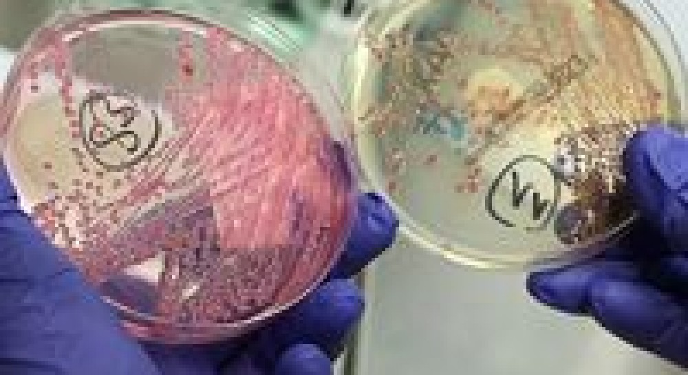 Можно ли избежать летних отравлений