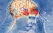 Может ли мигрень спровоцировать инсульт?
