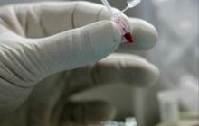 В Житомире строитель заболел малярией