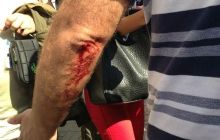 Яценюк розповів, як міліція била нардепів: кількох забрали в лікарню (фото, відео)