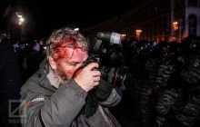 Під час розгону Євромайдану «беркутівці» розбили голову фотокореспонденту Reuters