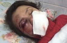 Крашкова: Винні не повинні залишитися безкарними у ситуації з Чорновол