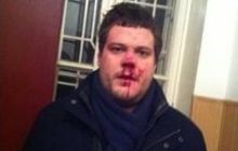 Милиция проведет 5 экспертиз по делу об избиении депутата Ильенко