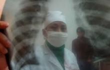 Зафиксированы случаи заражения людей туберкулезом от домашних кошек