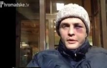 Побитий Ігор Луценко переживає за свого товариша по нещастю