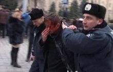 Избитый в Харькове писатель Жадан раскритиковал Кернеса и Авакова