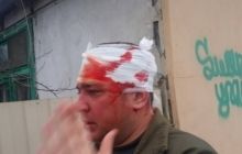 В Одесі після від'їзду Царьова прихильники РФ побили активістів Євромайдану