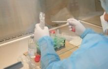 60% ВИЧ-инфицированных пациентов умирают вследствие туберкулеза