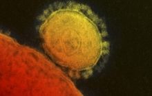 У США підтверджено 2 випадки зараження коронавірусом MERS
