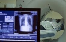 В Японии успешно провели уникальную операцию по пересадке легкого