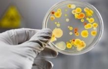 СЕС виявила сальмонелу у продуктах, які вживали гості на обіді в Андрушівці
