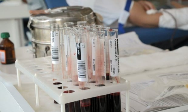 Анализ крови на наличие вирусов и ифекций / Фото: УНИАН