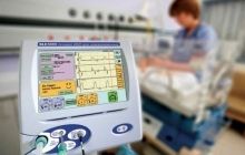 Житомирському військовому госпіталю подарували апарат штучної вентиляції легень