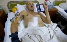 В лечебных заведениях Украины медпомощь получили 2924 раненых солдат