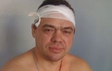 Підполковник ДСНС та газовик підірвалися на розтяжці бойовиків під час ремонту газопроводу