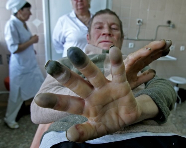 Только минувшие сутки от переохлаждений и обморожений пострадали 50 украинцев \ Фото: УНИАН