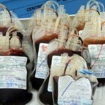 Болезнь Альцгеймера может передаваться при переливании крови - открытие ученых