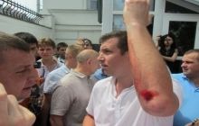 Мэр Полтавы на своем авто сбил депутата горсовета и нескольких пикетчиков (фото, видео)