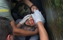 У постраждалого біля Ради журналіста з Франції струс мозку та черепно-мозкова травма (фото)