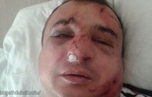 В Киеве избили луганского сепаратиста Клинчаева