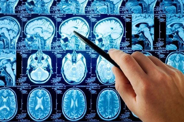 ключевую роль играет белое вещество, соединяющее исполнительную систему мозга с системой награды / rus-img2.com