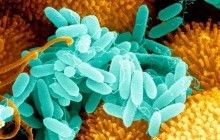 Учёные США разработали тест-систему, которая "распознаёт" в ране бактерии за 1 минуту