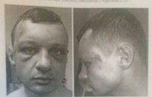 В СБУ объяснили побои "азовца" Краснова "жестким" задержанием в лесу