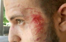 Напад на журналіста "Громадського ТБ Запоріжжя": ЗМІ вимагає розслідувати подію (фото)