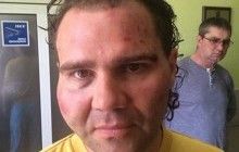 На Рівненщині депутата від УКРОПу могли побити через його діяльність у міськраді