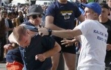 У избитого российскими фанатами англичанина отключился мозг