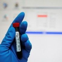 Russians no longer dispute Olympic doping operation - NYT
