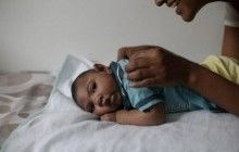 Генетики выяснили причину микроцефалии у новорожденных из-за вируса Зика