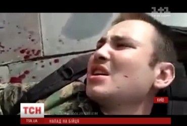 У Києві активіста ОУН невідомий поранив ножем