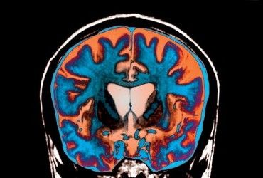 Навіть прибирання може сповільнити старіння мозку