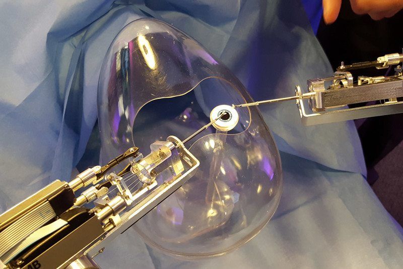 Робот-хирург для удаления катаракты оборудован двумя 