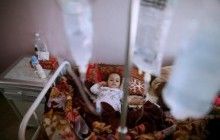 В Йемене растут показатели распространения холеры - ВОЗ