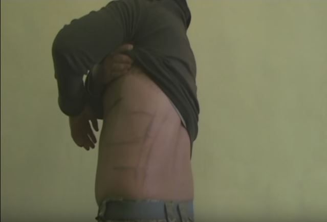 Військові розповіли, що у полоні їх били та ламали кістки / Служба безпеки України YouTube Військові розповіли, що у полоні їх били та ламали кістки / Служба безпеки України YouTube