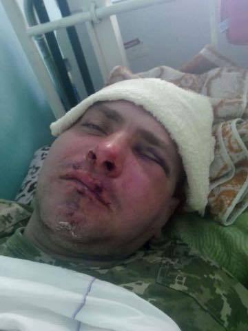 В Измаиле избили добровольца / www.facebook.com/psodesa В Измаиле избили добровольца / www.facebook.com/psodesa