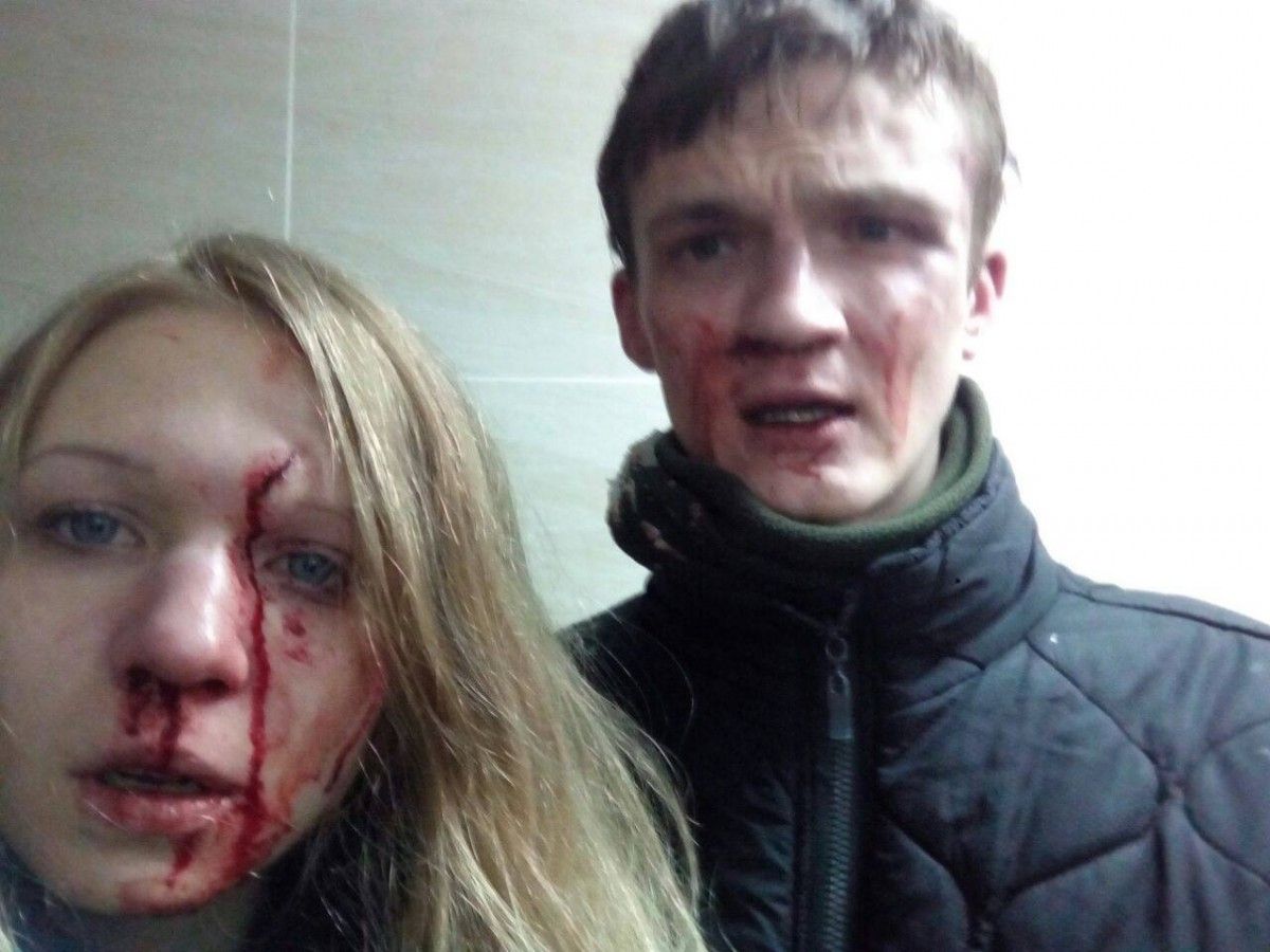 Заверуха та її хлопець оприлюднили фото на доказ того, що їх побили / Facebook Олесь Невідоменко Заверуха та її хлопець оприлюднили фото на доказ того, що їх побили / Facebook Олесь Невідоменко