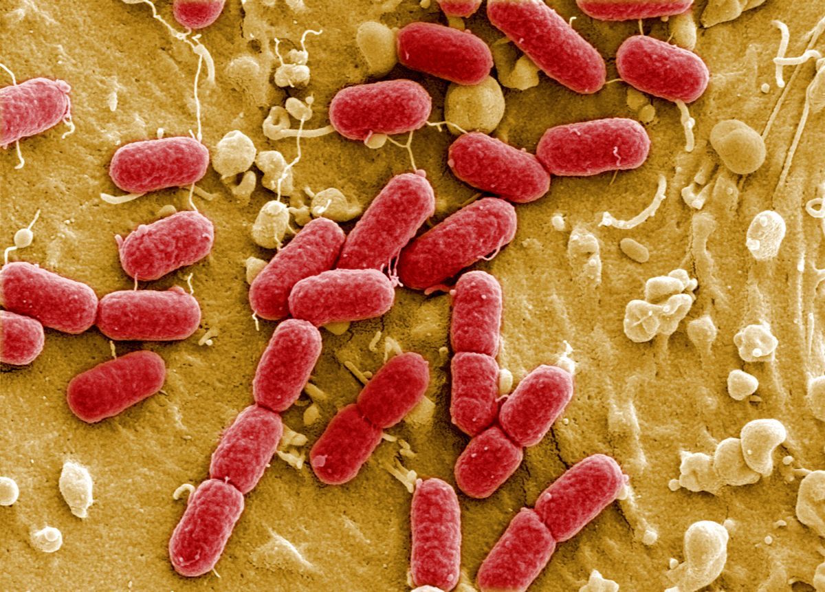 условно-патогенные бактерии