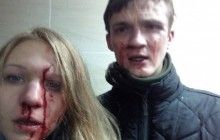 Вита Заверуха заявила об избиении (фото)