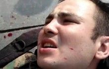 Полиция нашла мужчину, который в Киеве напал с ножом добровольца ОУН