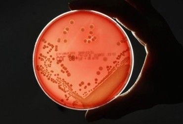 Бактерії стали більш стійкими до антисептиків на основі спирту - вчені