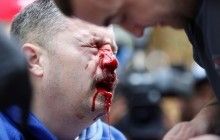 У США вимагають опублікувати податкову декларацію Трампа, на мітингу у Каліфорнії сталася бійка (фоторепортаж)
